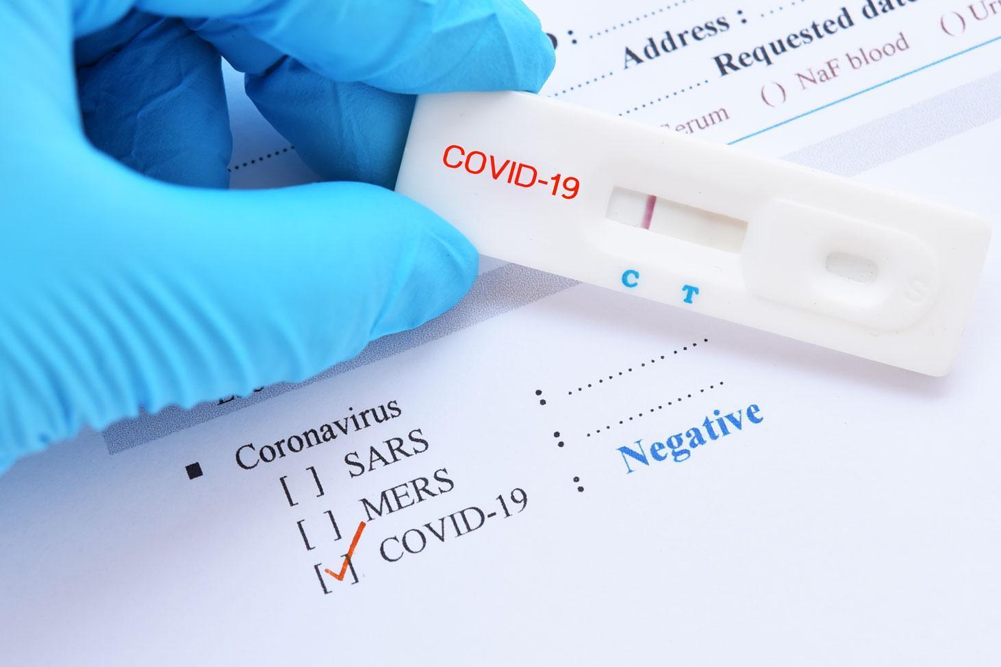 Tests antigéniques COVID 19